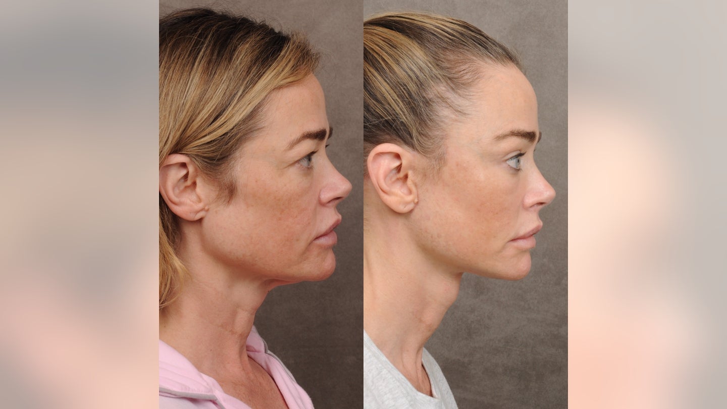 denise-richards-side-profile-2.jpg