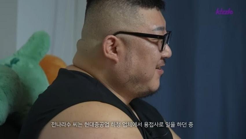 다리가 절단된 조선업 청년의 현실..jpg