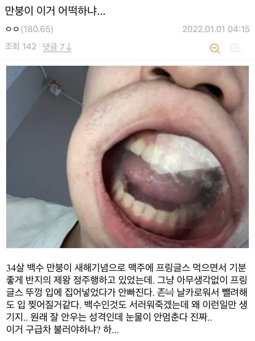 1.jpg 프링글스 뚜껑 입에낀 디씨인.jpg