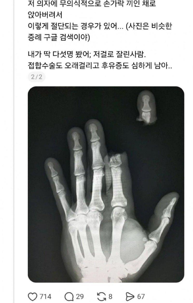 고깃집에서 손가락 절단 사고 많이 나게 하는 의자있으니 주의3.jpeg