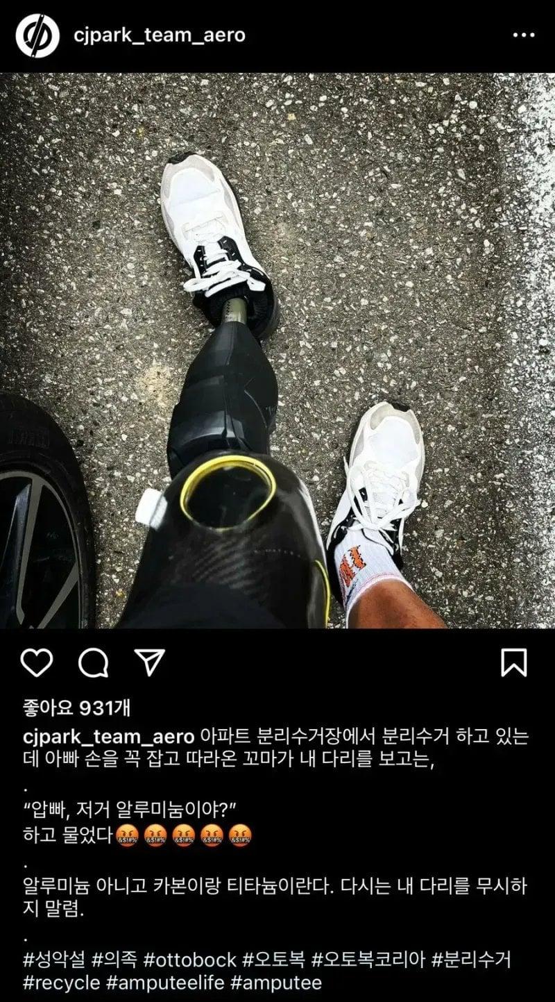 18e6534eace4aed54.webp.ren.jpg 아이의 한마디에 상처입은 다리 없는 남자jpg