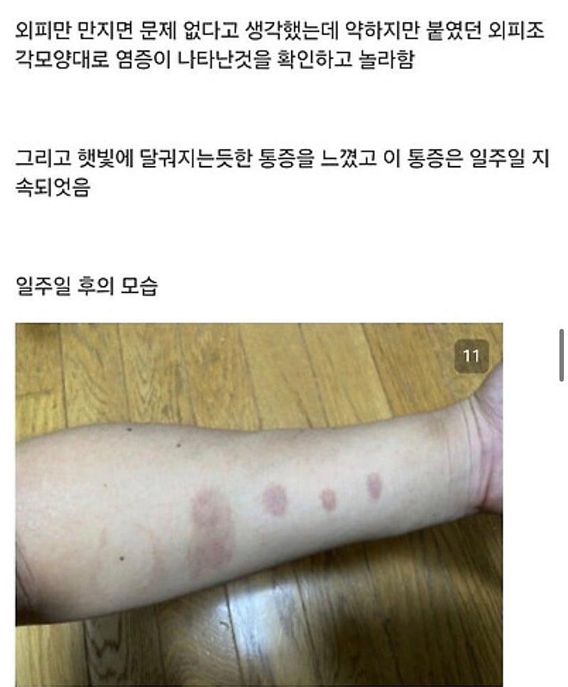 28931.jpg 붉은사슴뿔버섯을 본인 몸에 실험한 일본인.jpg