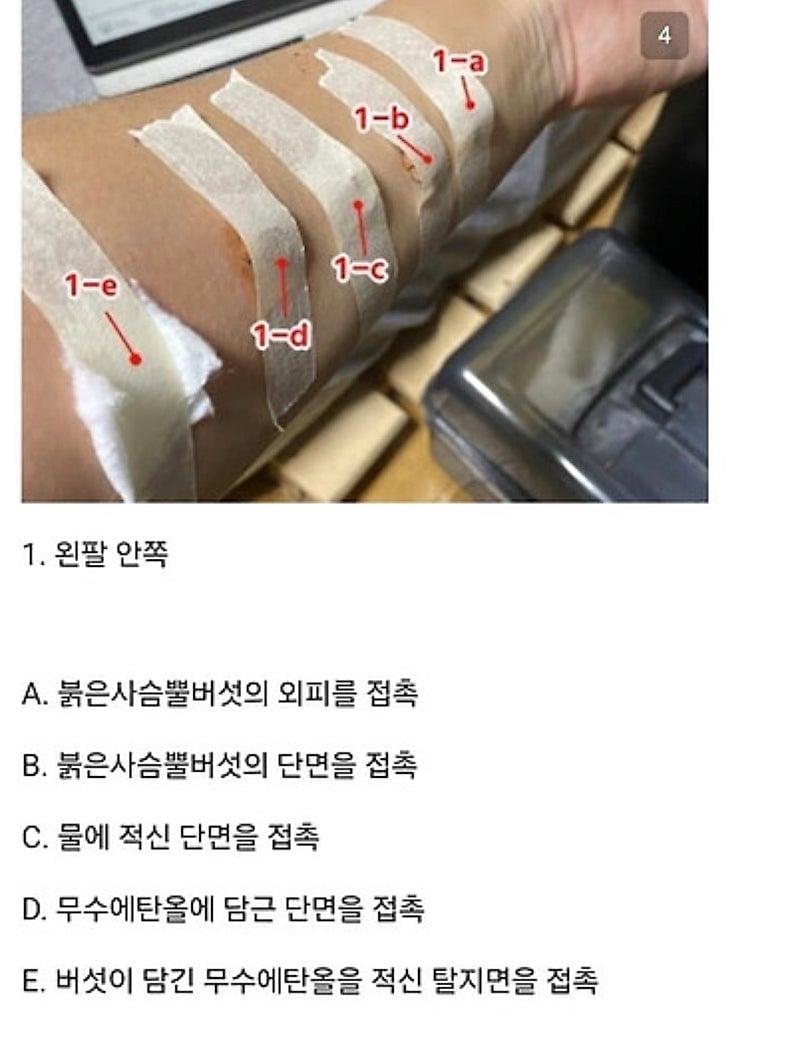 28925.jpg 붉은사슴뿔버섯을 본인 몸에 실험한 일본인.jpg