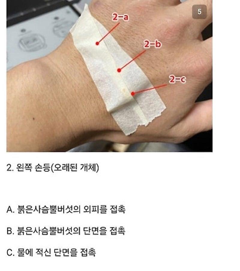 28926.jpg 붉은사슴뿔버섯을 본인 몸에 실험한 일본인.jpg