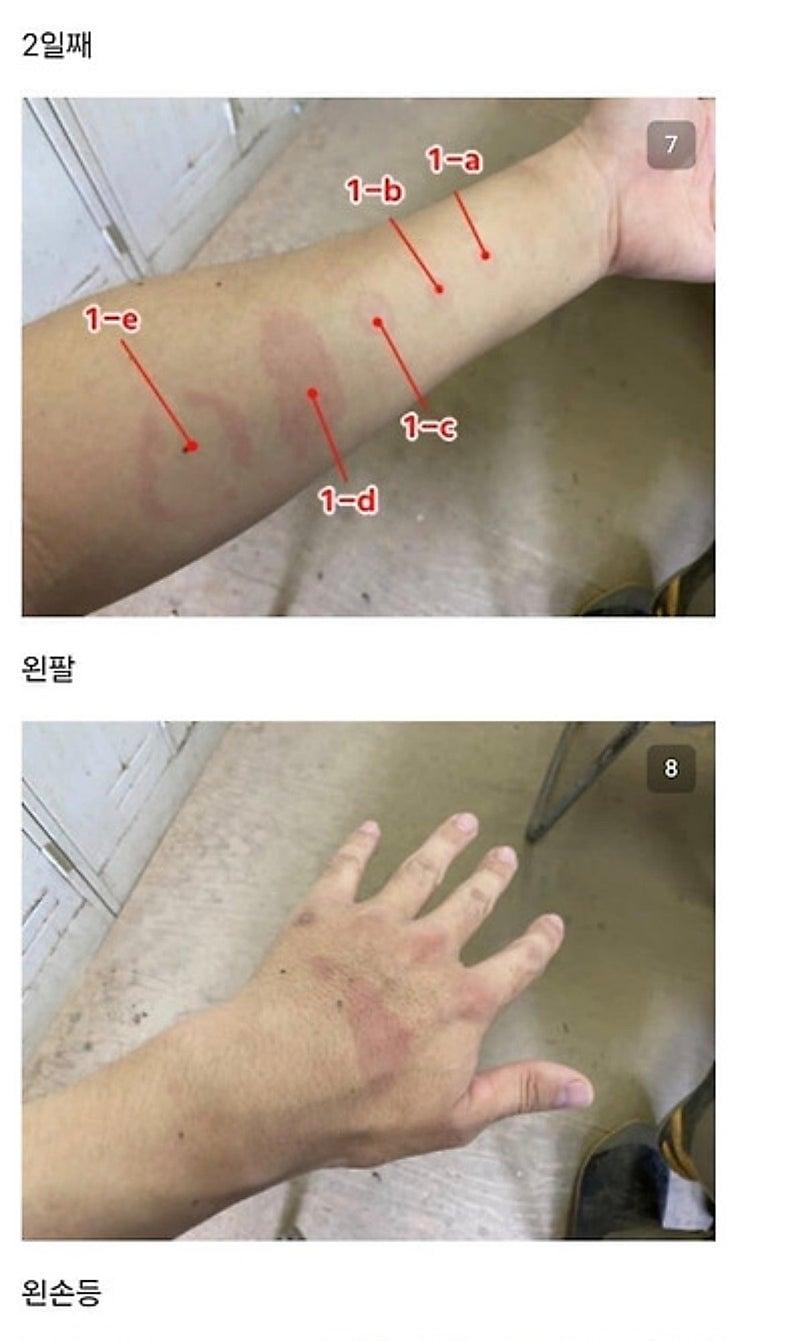 28929.jpg 붉은사슴뿔버섯을 본인 몸에 실험한 일본인.jpg
