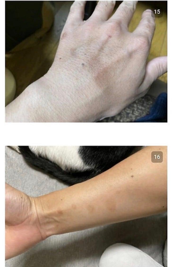 28934.jpg 붉은사슴뿔버섯을 본인 몸에 실험한 일본인.jpg