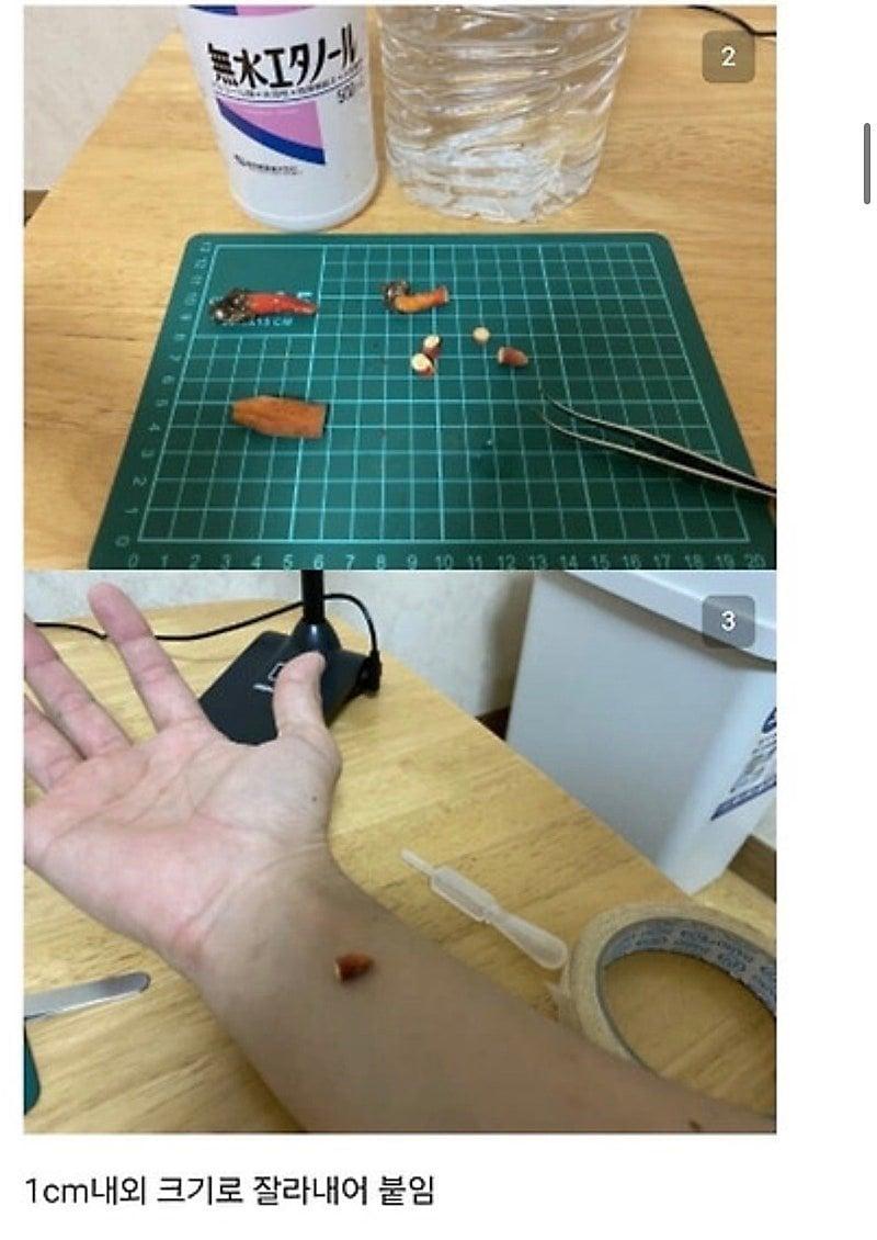 28924.jpg 붉은사슴뿔버섯을 본인 몸에 실험한 일본인.jpg