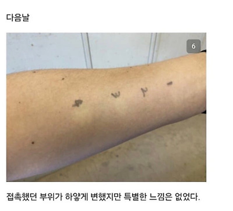 28928.jpg 붉은사슴뿔버섯을 본인 몸에 실험한 일본인.jpg