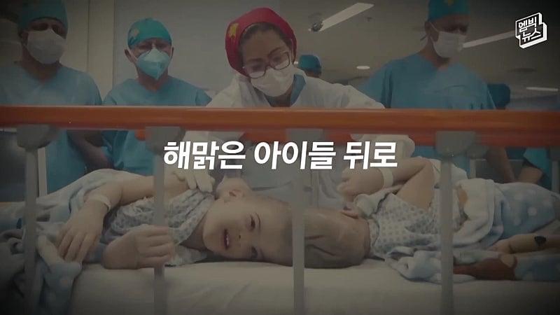 33시간 수술 끝에 얼굴 본 쌍둥이.jpg