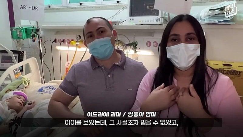 33시간 수술 끝에 얼굴 본 쌍둥이.jpg