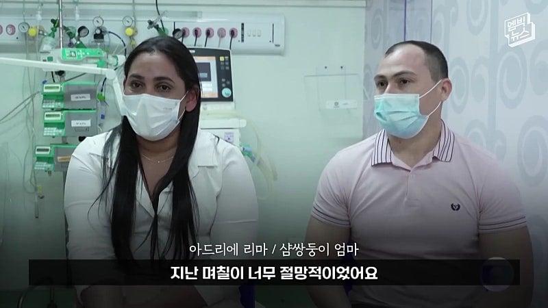 33시간 수술 끝에 얼굴 본 쌍둥이.jpg