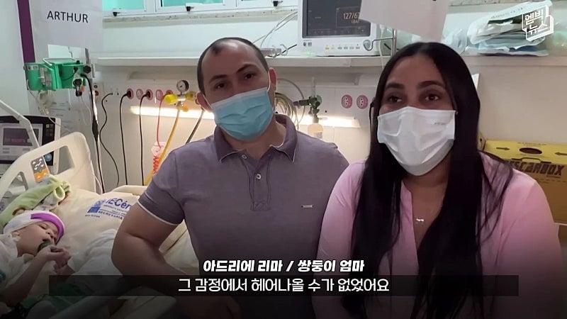 33시간 수술 끝에 얼굴 본 쌍둥이.jpg