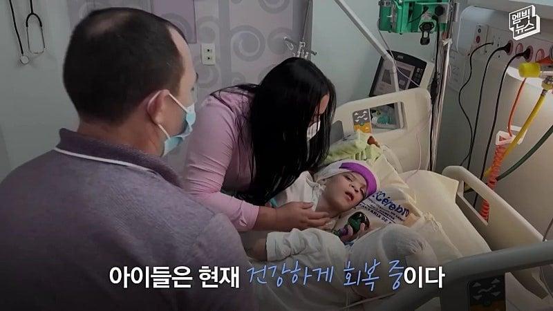 33시간 수술 끝에 얼굴 본 쌍둥이.jpg
