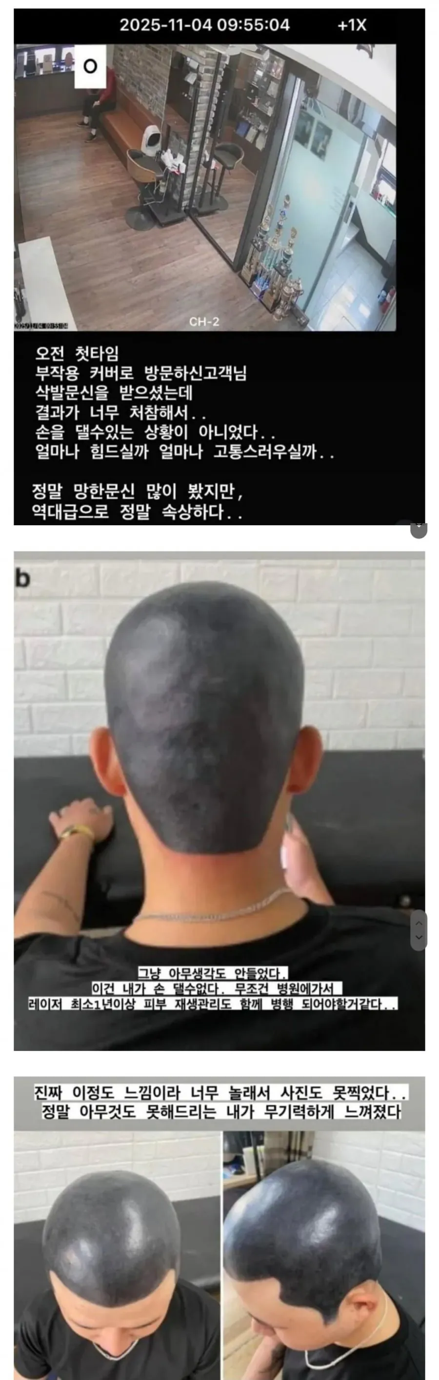 1212.jpg 타투샵 사장이 병원 가라고 한 문신