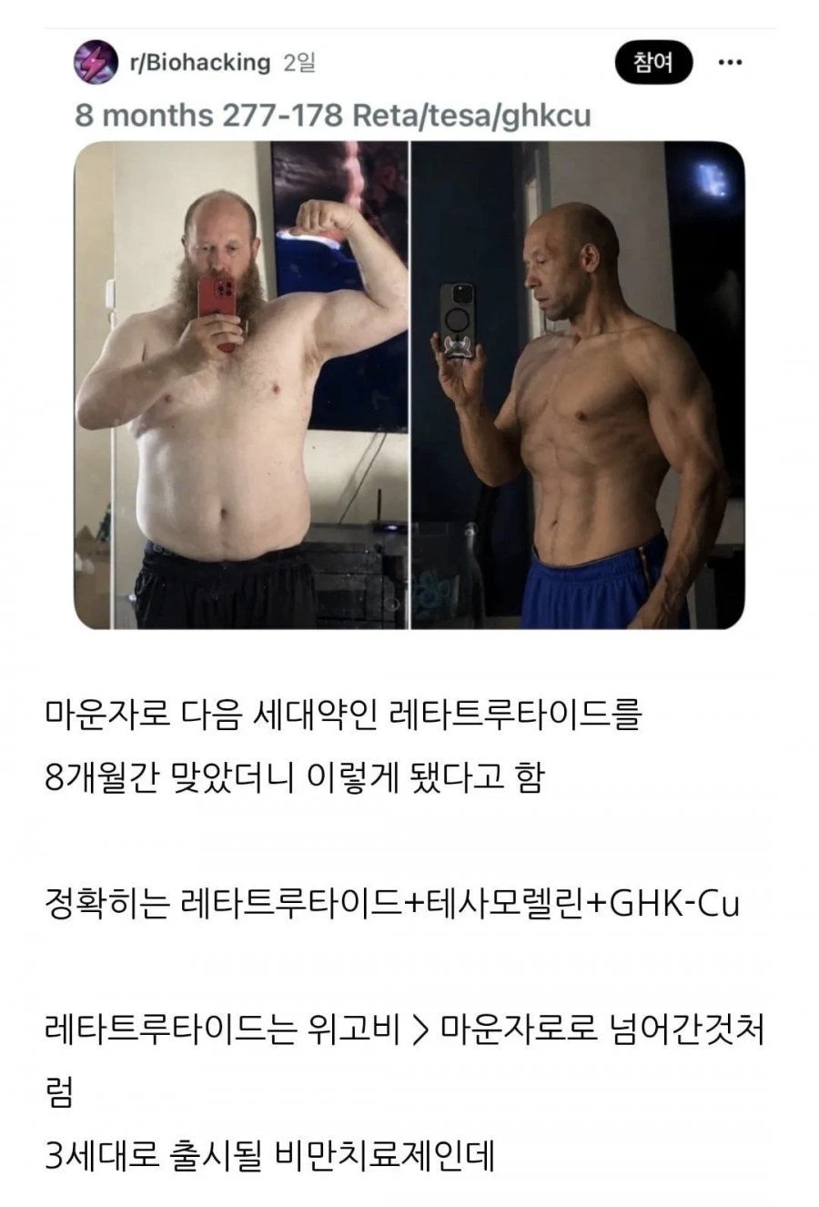 현재) 난리난 차세대 꿈의 비만치료제 ㄷㄷ