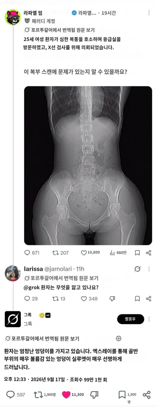 image.png AI 영상의학과 거의 대체 가능..