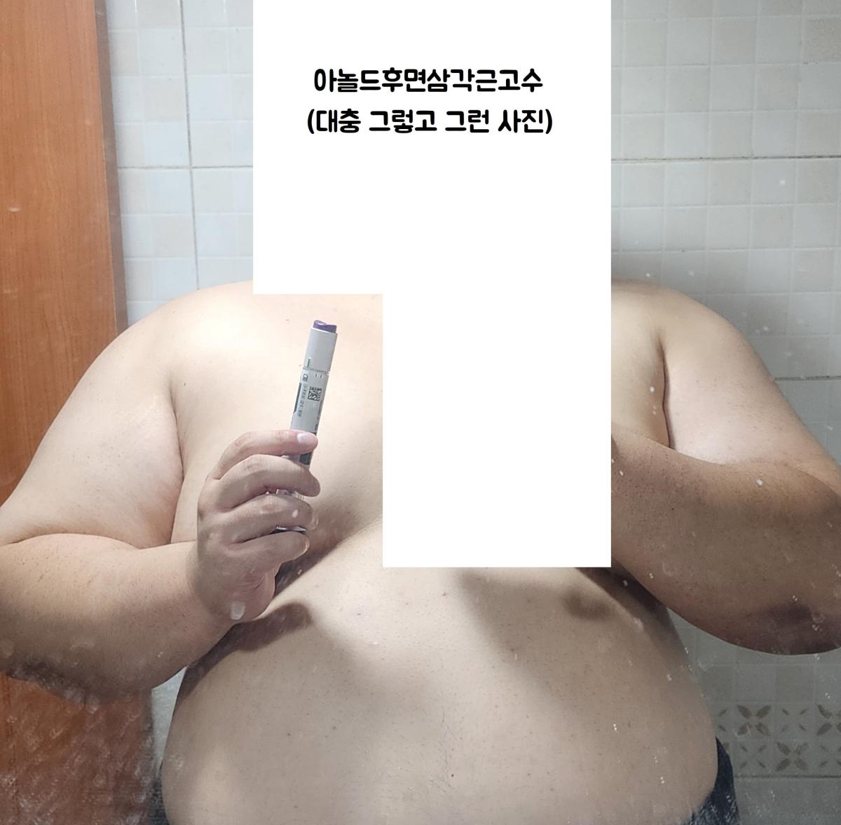 마운자로 처방 받은 날임 (20260928).jpg