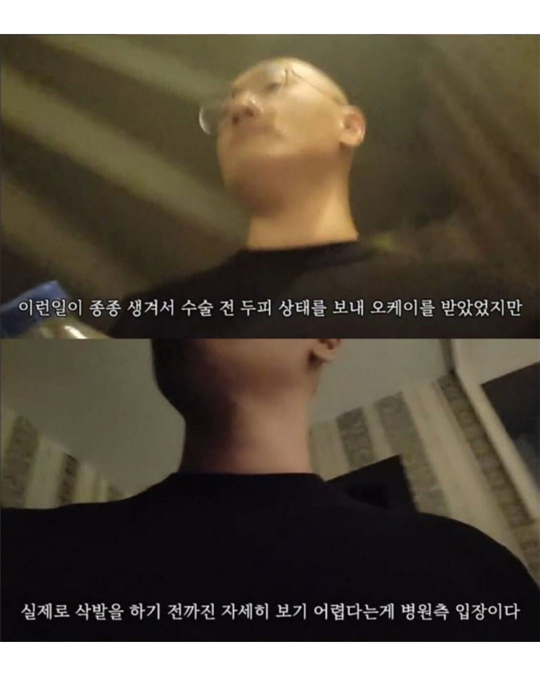 b3b6698cc0e947769017223d8fb0a50a.jpg 터키로 모발이식 받으러간 남자의 최후.jpg