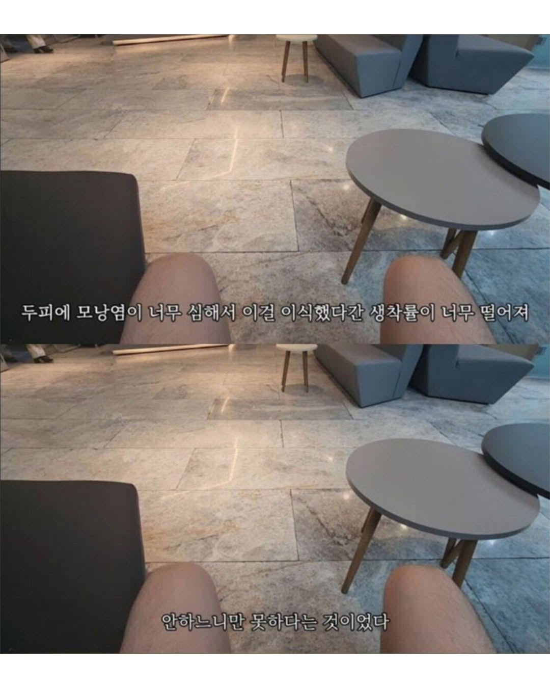 9aff4cce2ff042e9a7d7b595b1e90f02.jpg 터키로 모발이식 받으러간 남자의 최후.jpg
