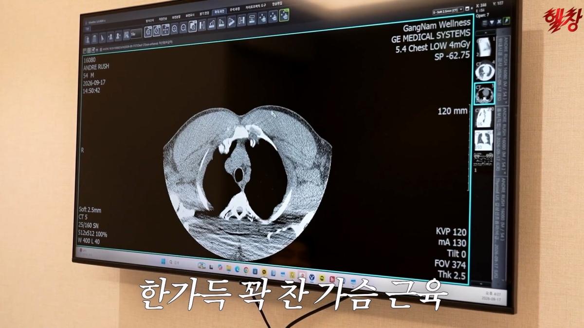미국엔 왜 이런게 없을까요._ 인생 첫 건강검진 받고 충격 먹은 백악관 셰프_20261005_175014.422.jpg