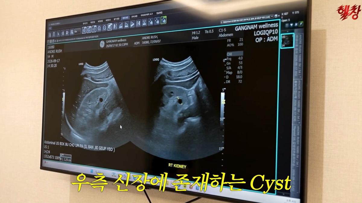 미국엔 왜 이런게 없을까요._ 인생 첫 건강검진 받고 충격 먹은 백악관 셰프_20261005_174913.734.jpg