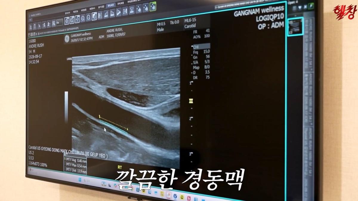 미국엔 왜 이런게 없을까요._ 인생 첫 건강검진 받고 충격 먹은 백악관 셰프_20261005_174851.239.jpg