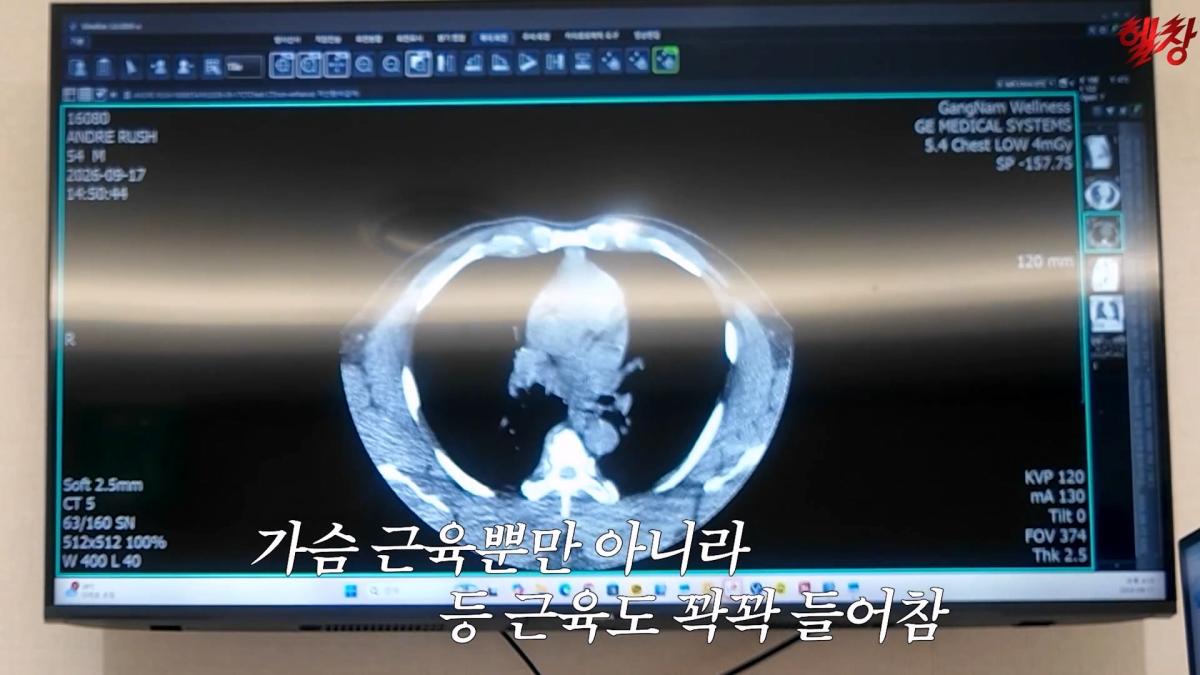 미국엔 왜 이런게 없을까요._ 인생 첫 건강검진 받고 충격 먹은 백악관 셰프_20261005_175039.750.jpg