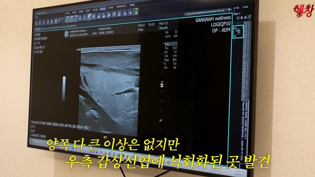 미국엔 왜 이런게 없을까요._ 인생 첫 건강검진 받고 충격 먹은 백악관 셰프_20261005_174819.662.jpg