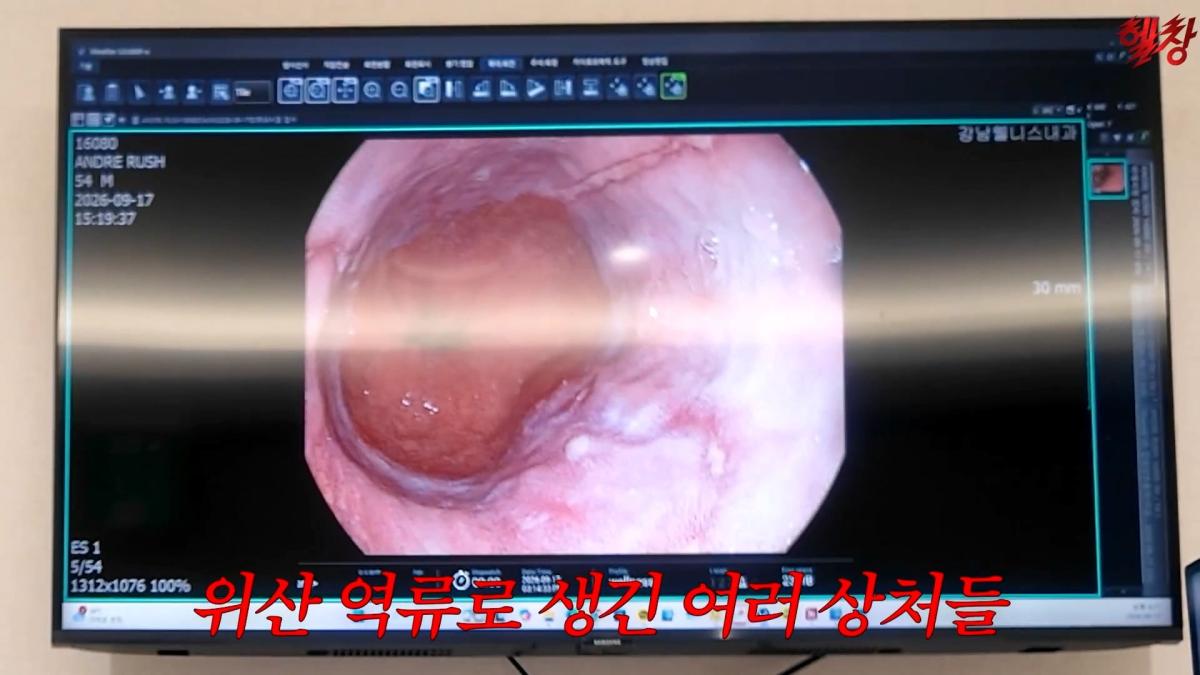 미국엔 왜 이런게 없을까요._ 인생 첫 건강검진 받고 충격 먹은 백악관 셰프_20261005_175243.581.jpg